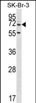 Rabbit Polyclonal Antibody to ZNF398