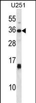 Rabbit Polyclonal Antibody to STC1