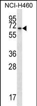 Rabbit Polyclonal Antibody to BEND4 (N-term)