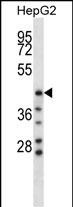 Rabbit Polyclonal Antibody to HYAL1