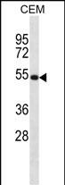 Rabbit Polyclonal Antibody to NTN3