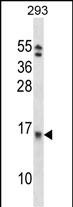 Rabbit Polyclonal Antibody to EIF1B