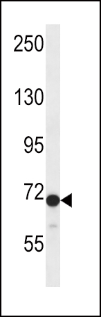 Rabbit Polyclonal Antibody to DVL2