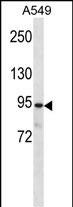Rabbit Polyclonal Antibody to PKP3
