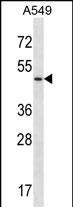Rabbit Polyclonal Antibody to UTS2R