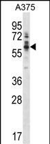 Rabbit Polyclonal Antibody to Mouse Ptk6 (N-term)