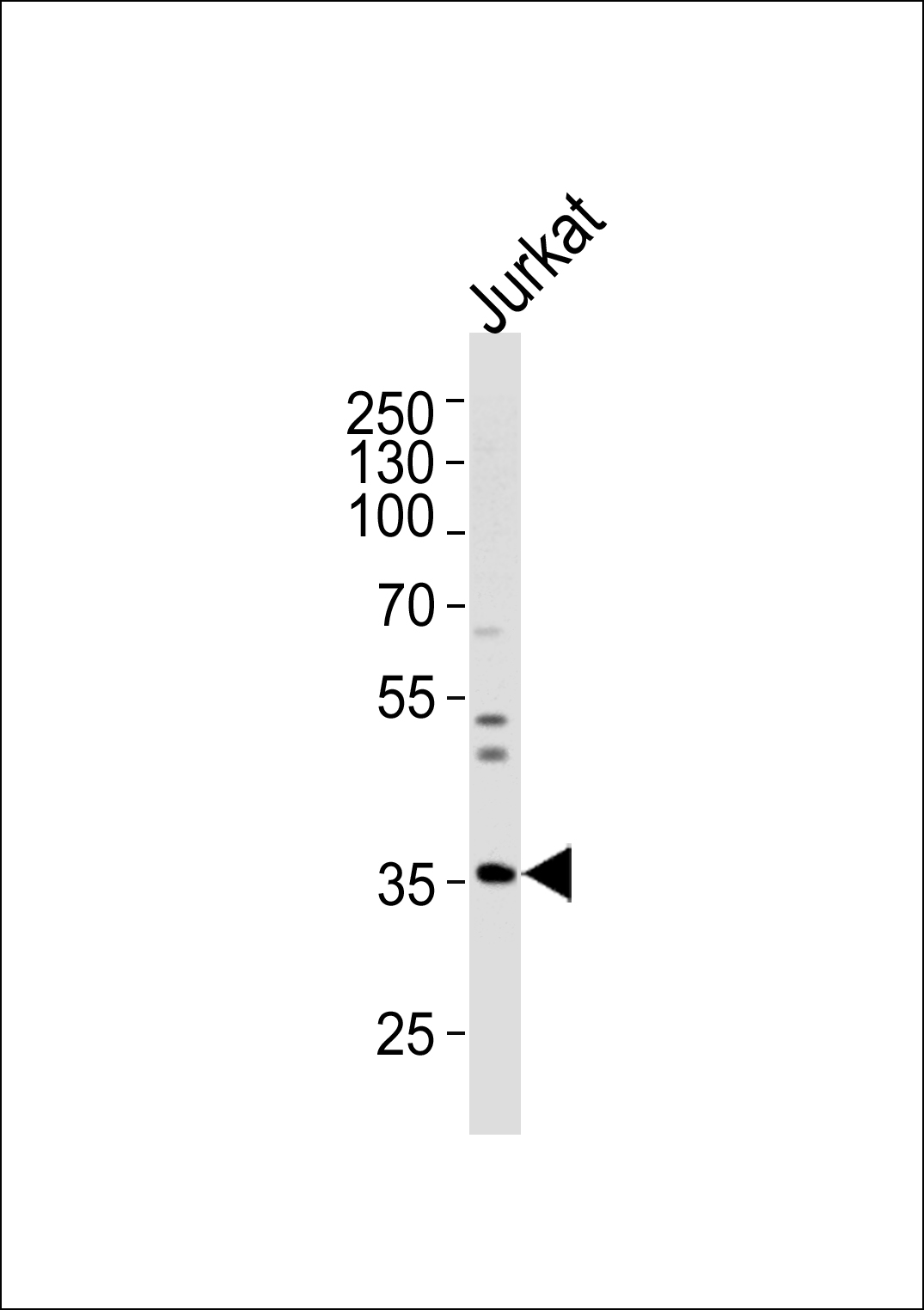 Rabbit Polyclonal Antibody to GLRB (N-term)