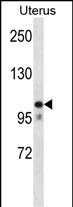 Rabbit Polyclonal Antibody to MOV10 (N-term)