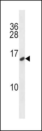 Rabbit Polyclonal Antibody to CALCA/CT