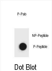 Rabbit Polyclonal Antibody to Phospho-Belcin 1