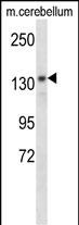 Rabbit Polyclonal Antibody to POLG