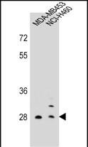 Rabbit Polyclonal Antibody to FOLR2 (N-term)