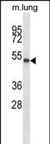 Rabbit Polyclonal Antibody to PBX2