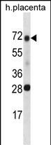 Rabbit Polyclonal Antibody to SPINT1