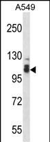 Rabbit Polyclonal Antibody to SMEK2