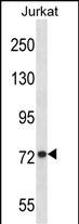 Rabbit Polyclonal Antibody to MFN1