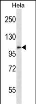 Rabbit Polyclonal Antibody to ZFPM2