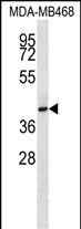 Rabbit Polyclonal Antibody to CD200R1