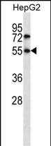 Rabbit Polyclonal Antibody to NR4A3