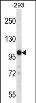 Rabbit Polyclonal Antibody to TRPM4