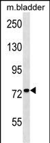Rabbit Polyclonal Antibody to Mouse Cabc1