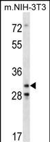 Rabbit Polyclonal Antibody to Mouse Cdk4