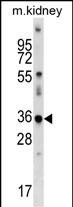 Rabbit Polyclonal Antibody to Mouse Cdkl4