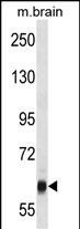 Rabbit Polyclonal Antibody to VPS45