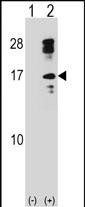 Rabbit Polyclonal Antibody to CLC