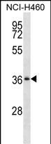 Rabbit Polyclonal Antibody to SERPINB1