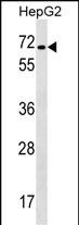 Rabbit Polyclonal Antibody to CACNB1