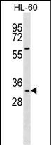 Rabbit Polyclonal Antibody to Mouse Hoxb13