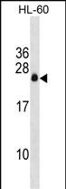 Rabbit Polyclonal Antibody to APRG1