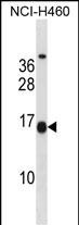 Rabbit Polyclonal Antibody to MSGN1