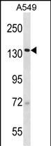 Rabbit Polyclonal Antibody to SF3B2