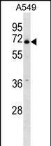 Rabbit Polyclonal Antibody to PLBD2