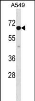 Rabbit Polyclonal Antibody to CLPTM1L