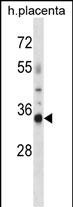 Rabbit Polyclonal Antibody to OR4K13 (N-term)