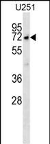 Rabbit Polyclonal Antibody to MKKS