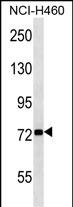 Rabbit Polyclonal Antibody to ZNF441 (N-term)