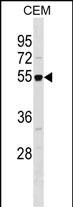Rabbit Polyclonal Antibody to RBBP7