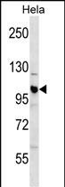 Rabbit Polyclonal Antibody to CUL1