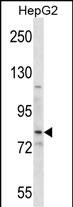 Rabbit Polyclonal Antibody to SMO