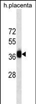 Mouse Monoclonal Antibody to GBX2(Ascites)