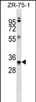 Mouse Monoclonal Antibody to MBP