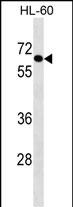 Rabbit Polyclonal Antibody to AIM1L