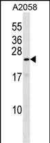 Rabbit Polyclonal Antibody to ZN673