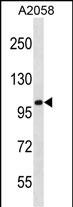 Rabbit Polyclonal Antibody to CCDC46 (N-term)