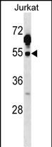 Rabbit Polyclonal Antibody to Mouse Csk