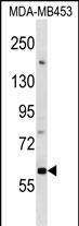 Rabbit Polyclonal Antibody to Mouse Dapk1 (N-term)